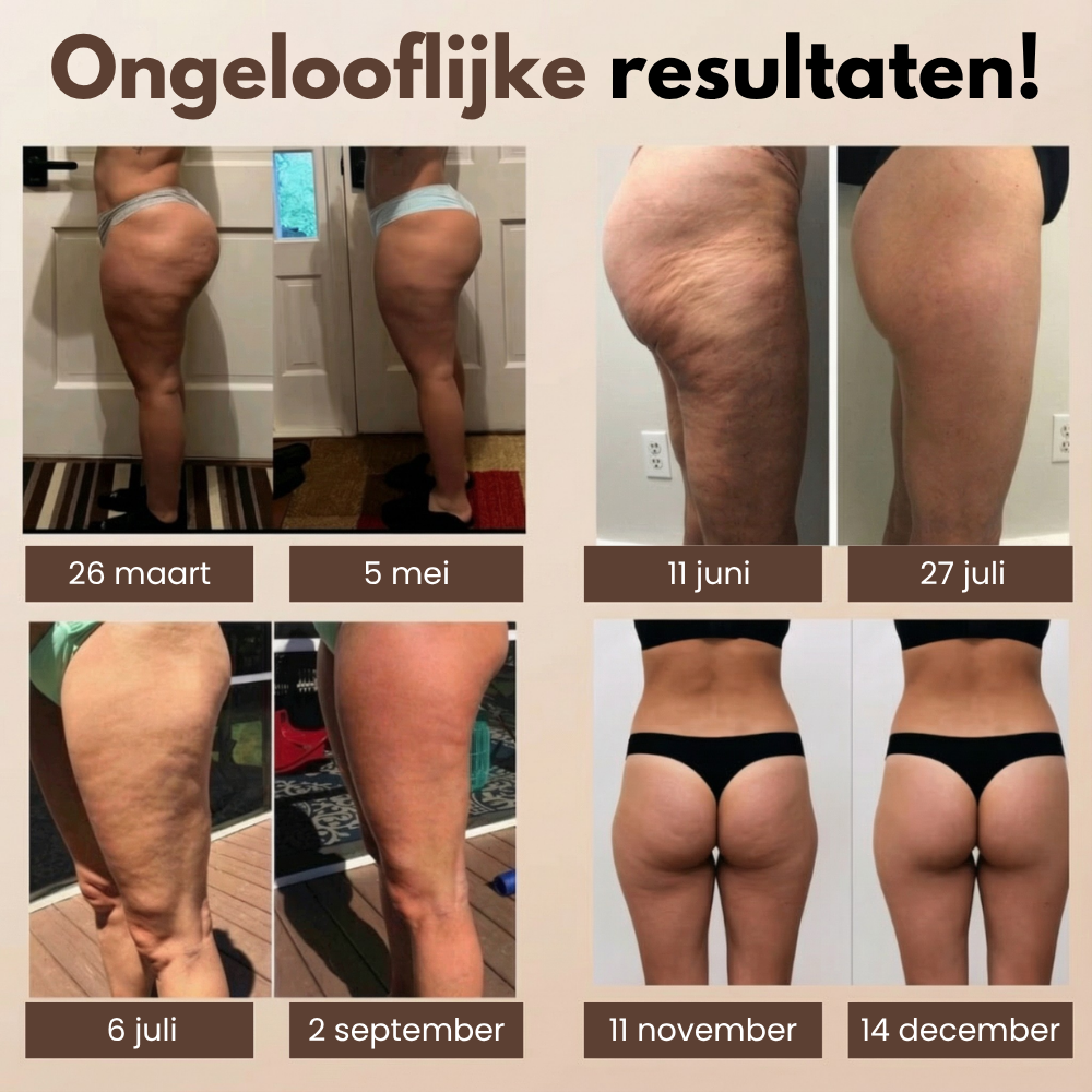 3D Anti-Cellulite Legging