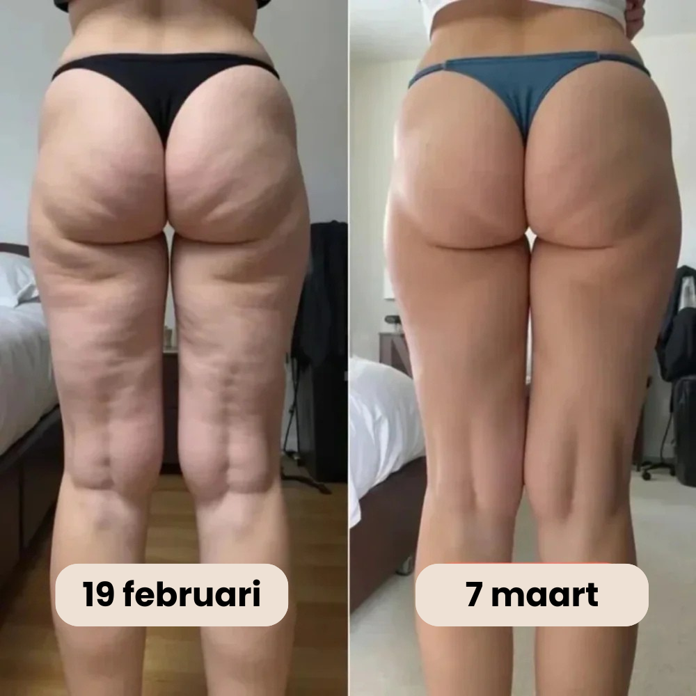 3D Anti-Cellulite Legging